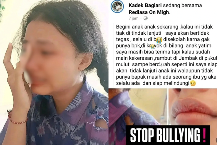 DENPASAR, BALINEWS.ID - Kasus dugaan perundungan dan penganiayaan terhadap seorang siswi SMP di Denpasar kini tengah diselidiki pihak kepolisian. Korban yang d…
