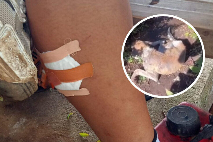 TABANAN, BALINEWS.ID - Menyusul laporan kasus gigitan anjing liar terhadap 15 pendaki di kawasan Gunung Batukaru, Dinas Kesehatan Kabupaten Tabanan langsung me…