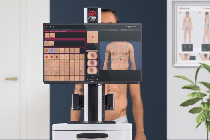 DENPASAR, BALINEWS.ID – Lumi Clinic has officially unveiled Indonesia’s first Skin Cancer Screening Center of Excellence, pioneering the use of FotoFinder ATBM…