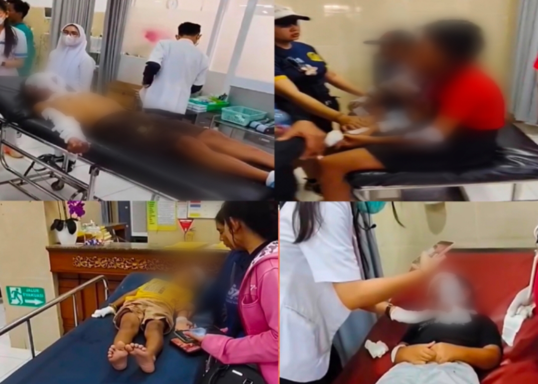SEMARAPURA, BALINEWS.ID – Sebanyak 11 orang mengalami luka bakar akibat ledakan balon gas yang digunakan dalam rangkaian pembukaan Peringatan Hari Koperasi ke-…