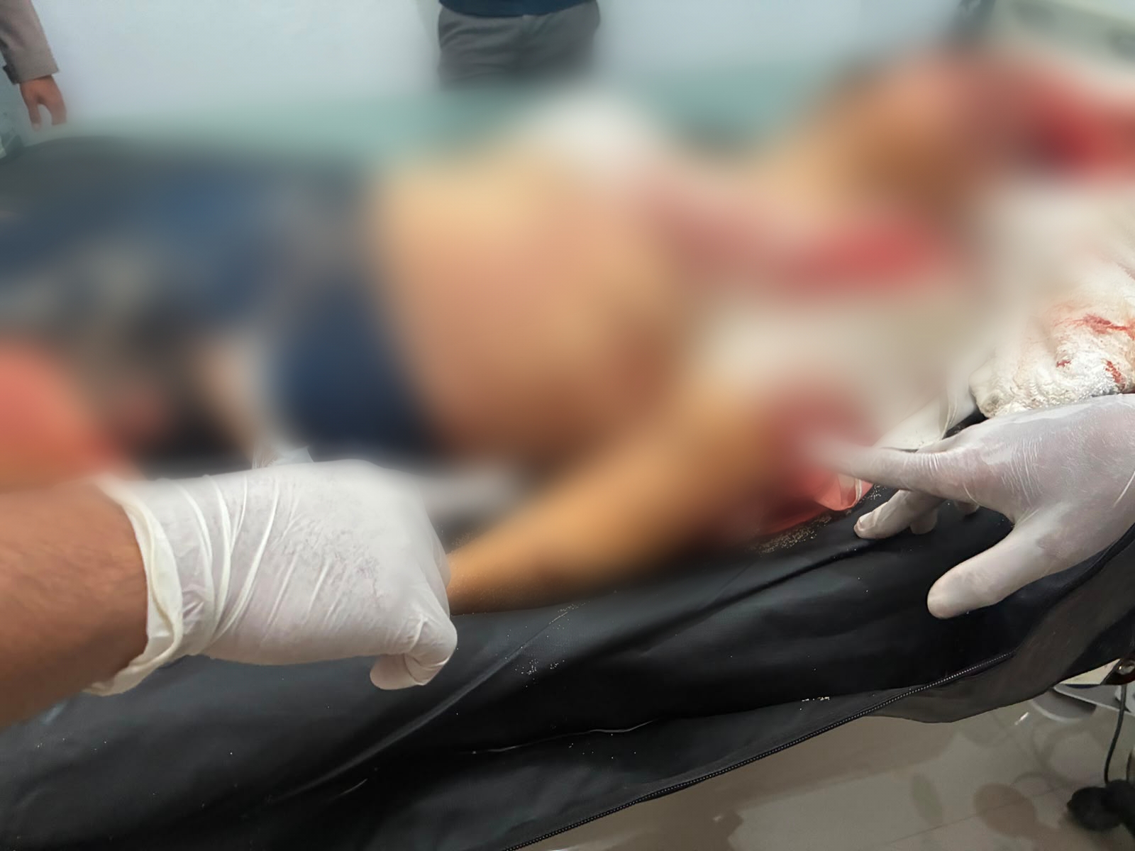 NUSA PENIDA, BALINEWS.ID – Seorang wisatawan mancanegara (WNA) asal Australia meninggal dunia setelah terjatuh dari tebing di kawasan objek wisata Kelingking B…