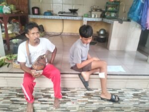 Korban gigitan anjing rabies (kanan) mengalami luka di bagian kaki.