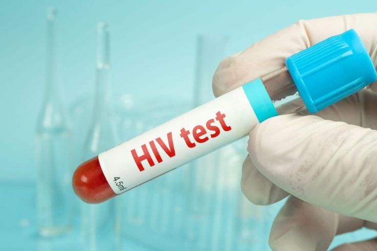 Ilustrasi HIV.