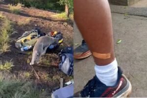 15 Pendaki Gunung Batukaru Digigit Anjing Liar langsung ditangani Dinkes setempat.