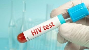 Ilustrasi HIV.